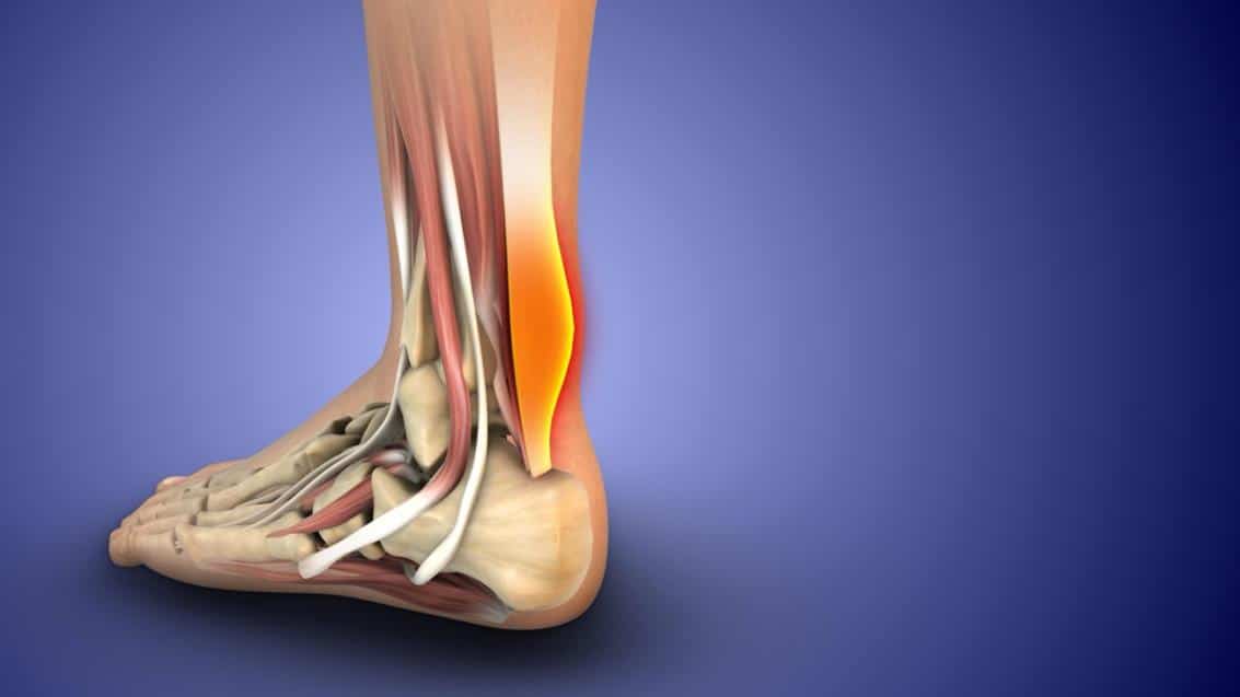 Anatomical detail of the Achilles tendon